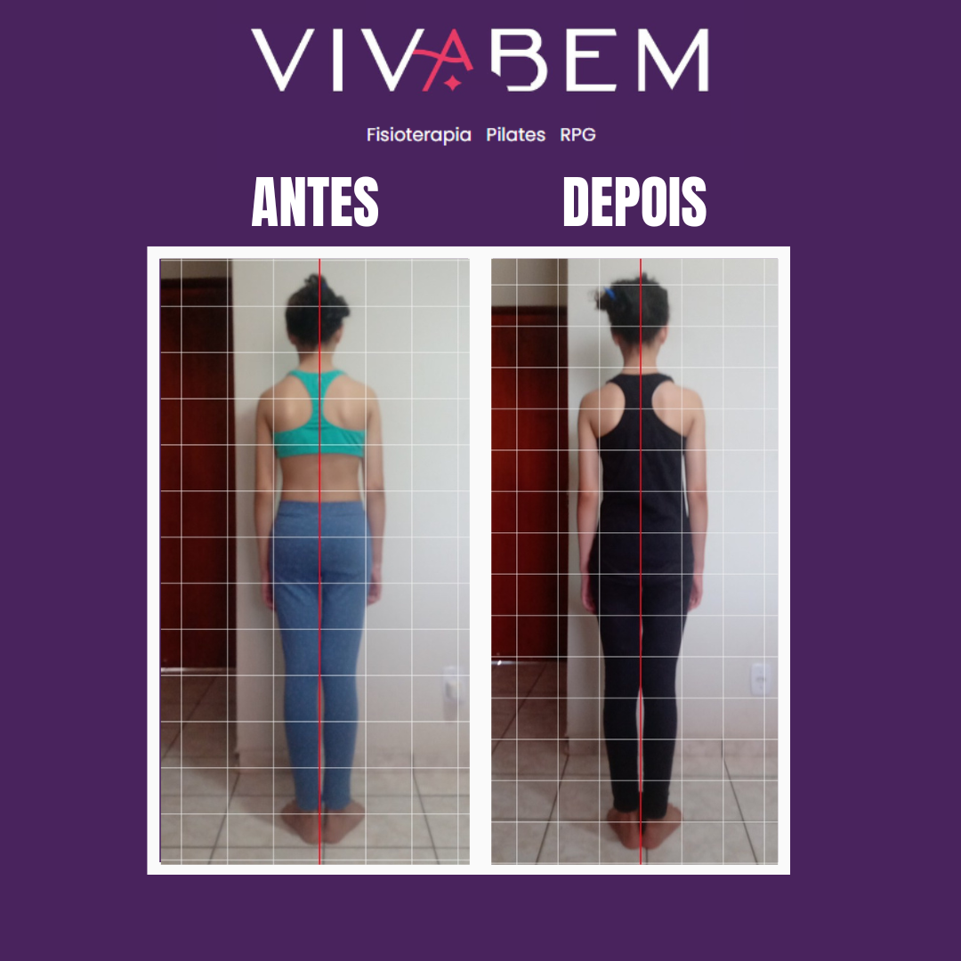 Cópia de PILATES 22 MEGA PACK CANVA (Cartaz (retrato) (42 cm × 59,4 cm)) (Post para Instagram (Quadrado))